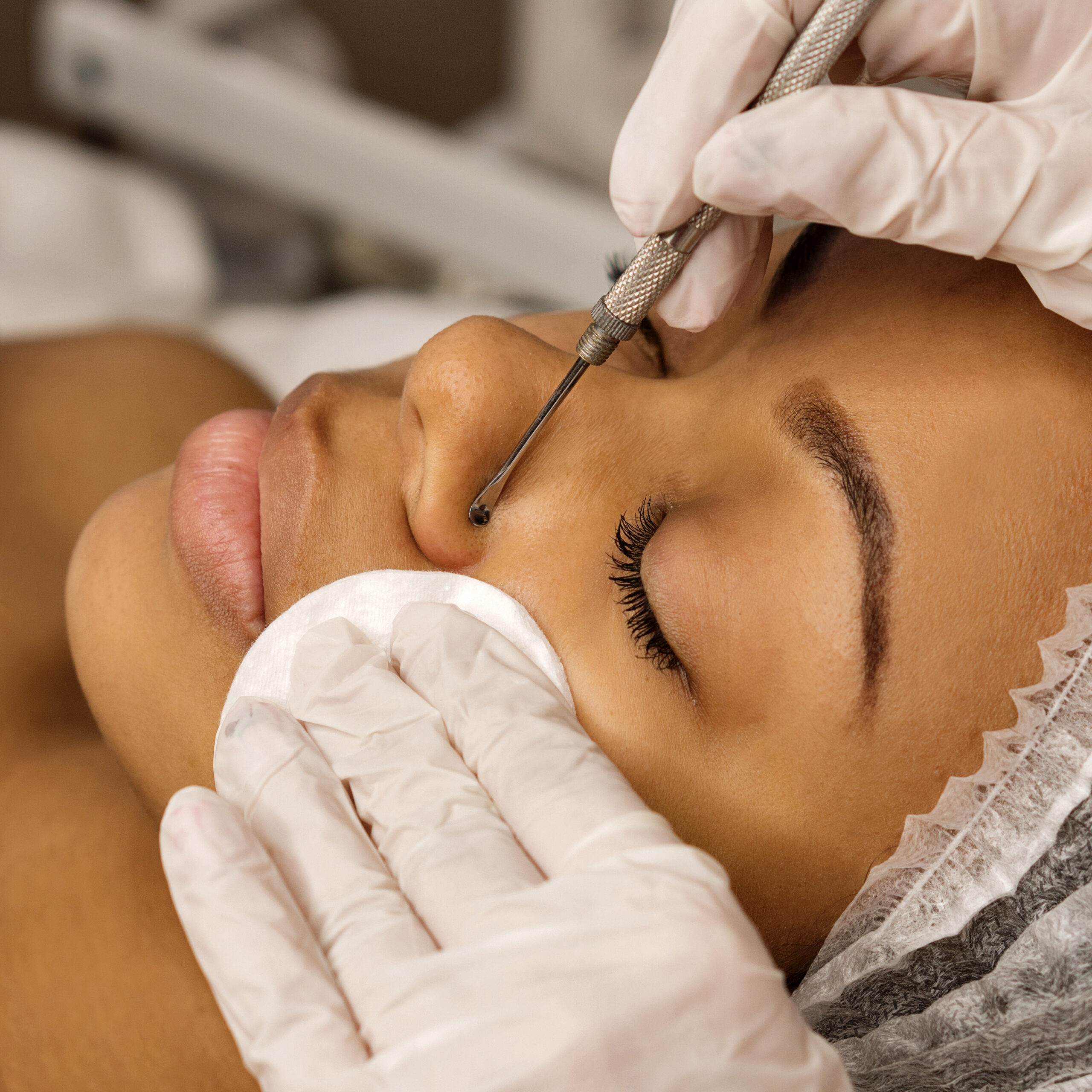 Procedure mechanical face cleaning in beauty salon. Afro american young model getting cosmetic face skin care and treatments in cosmetologist. Spa, cosmetology and wellness relaxation concept.