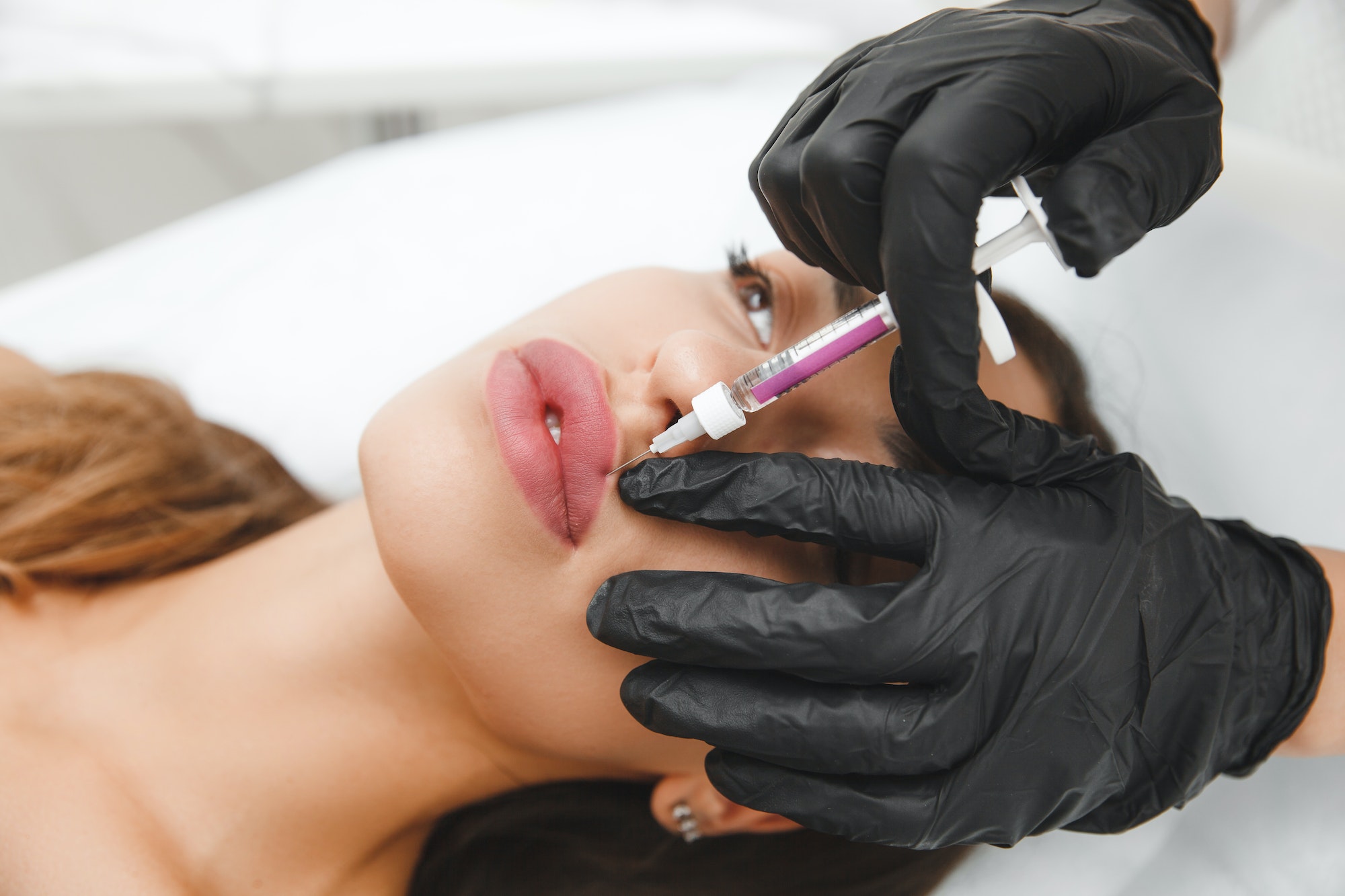 female lips, lip augmentation procedure. A syringe near a woman's mouth, injections to increase